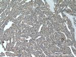 CHDH Antibody in Immunohistochemistry (Paraffin) (IHC (P))