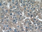 CHDH Antibody in Immunohistochemistry (Paraffin) (IHC (P))