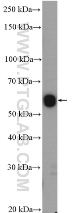 CHDH Antibody in Western Blot (WB)