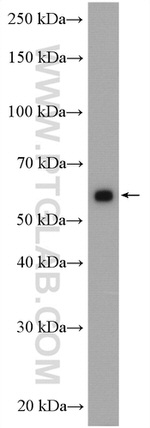 CHDH Antibody in Western Blot (WB)
