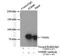 STRBP Antibody in Immunoprecipitation (IP)