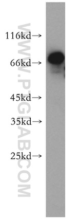 STRBP Antibody in Western Blot (WB)