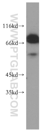 STRBP Antibody in Western Blot (WB)