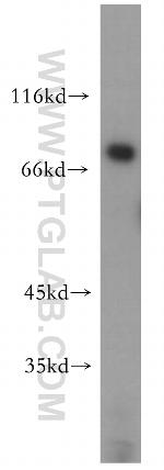 STRBP Antibody in Western Blot (WB)