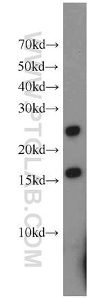 DNAJC5B Antibody in Western Blot (WB)