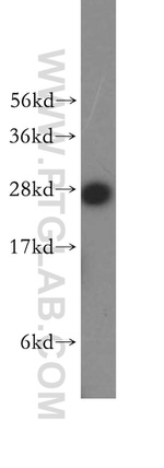 SNRPA1 Antibody in Western Blot (WB)