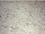 TEX10 Antibody in Immunohistochemistry (Paraffin) (IHC (P))