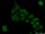 TEX10 Antibody in Immunocytochemistry (ICC/IF)