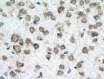 RPS29 Antibody in Immunohistochemistry (Paraffin) (IHC (P))