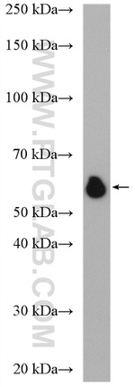 GPBP1L1 Antibody in Western Blot (WB)