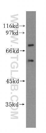 GPBP1L1 Antibody in Western Blot (WB)