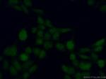 MAPK11 Antibody in Immunocytochemistry (ICC/IF)