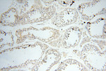 SAMD4A Antibody in Immunohistochemistry (Paraffin) (IHC (P))