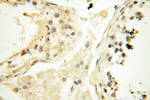 SAMD4A Antibody in Immunohistochemistry (Paraffin) (IHC (P))