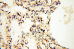 SAMD4A Antibody in Immunohistochemistry (Paraffin) (IHC (P))