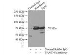 SAMD4A Antibody in Immunoprecipitation (IP)