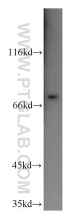 SAMD4A Antibody in Western Blot (WB)
