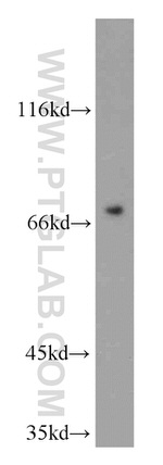SAMD4A Antibody in Western Blot (WB)