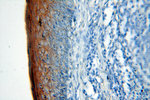 Cytokeratin 6B Antibody in Immunohistochemistry (Paraffin) (IHC (P))