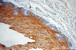Cytokeratin 6B Antibody in Immunohistochemistry (Paraffin) (IHC (P))