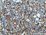 Cytokeratin 6B Antibody in Immunohistochemistry (Paraffin) (IHC (P))