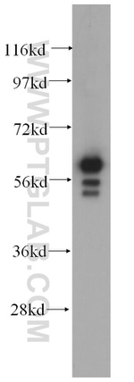 Cytokeratin 6B Antibody in Western Blot (WB)