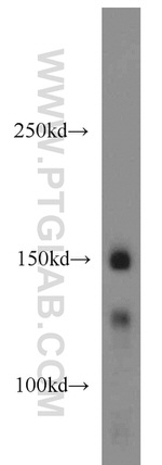 PRPF40A Antibody in Western Blot (WB)