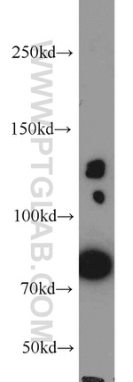 PRPF40A Antibody in Western Blot (WB)