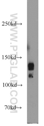PRPF40A Antibody in Western Blot (WB)