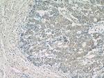 NUBPL Antibody in Immunohistochemistry (Paraffin) (IHC (P))