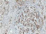 NUBPL Antibody in Immunohistochemistry (Paraffin) (IHC (P))