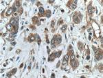 NUBPL Antibody in Immunohistochemistry (Paraffin) (IHC (P))