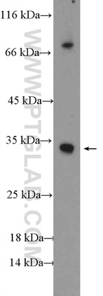 NUBPL Antibody in Western Blot (WB)