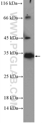 NUBPL Antibody in Western Blot (WB)