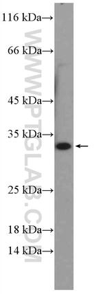 NUBPL Antibody in Western Blot (WB)