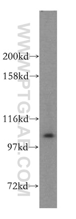 AlaRS Antibody in Western Blot (WB)