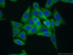 AlaRS Antibody in Immunocytochemistry (ICC/IF)