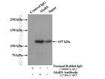 AlaRS Antibody in Immunoprecipitation (IP)