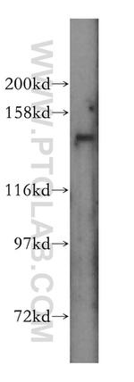 SLC9A11 Antibody in Western Blot (WB)