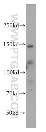 SLC9A11 Antibody in Western Blot (WB)