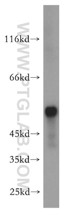 Peripherin Antibody in Western Blot (WB)