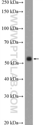 Peripherin Antibody in Western Blot (WB)