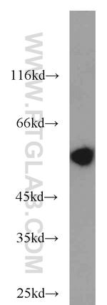 Peripherin Antibody in Western Blot (WB)