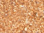 AFP (Alpha Fetoprotein) Antibody in Immunohistochemistry (Paraffin) (IHC (P))