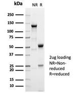 AFP (Alpha Fetoprotein) (Hepatocellular/Germ Cell Tumor Marker) Antibody in SDS-PAGE (SDS-PAGE)
