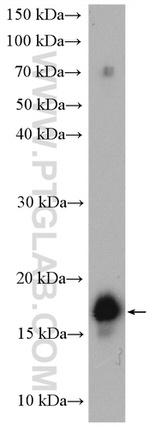 FGF1 Antibody in Western Blot (WB)