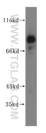 PSD2 Antibody in Western Blot (WB)