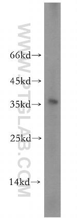 TGIF2LX Antibody in Western Blot (WB)