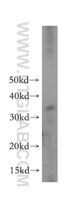 TGIF2LX Antibody in Western Blot (WB)