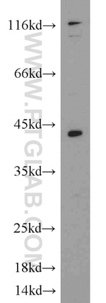SYCE1 Antibody in Western Blot (WB)